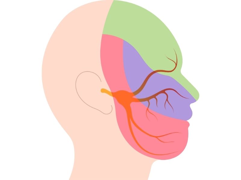 trigeminal-nevralji-nedir